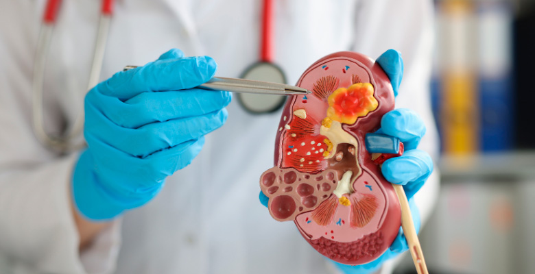 Mais de 30 % dos portugueses não sabe que a doença renal crónica pode ser prevenida